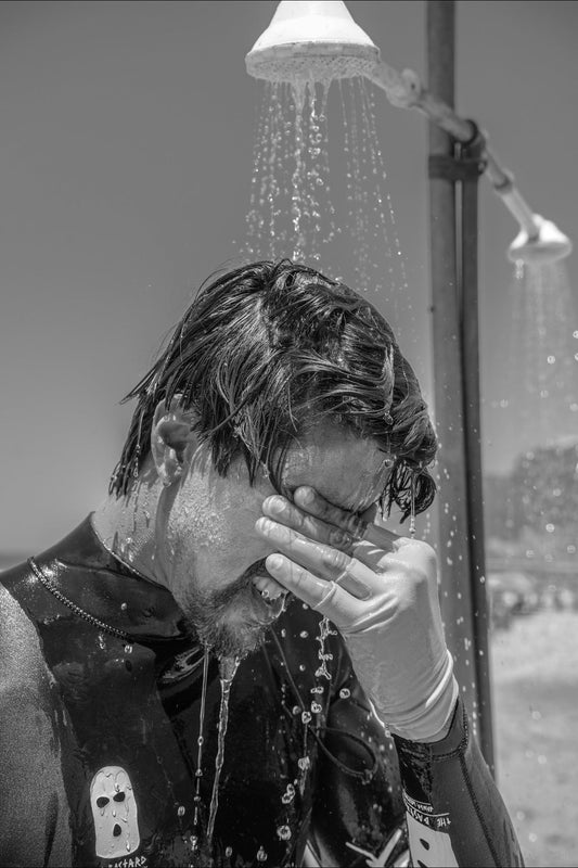 How to Take Care of Your Skin After Surfing: The Surfer’s Skincare Routine